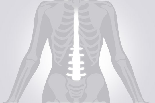 허리 MRI(요추정밀) 검사부위 그림