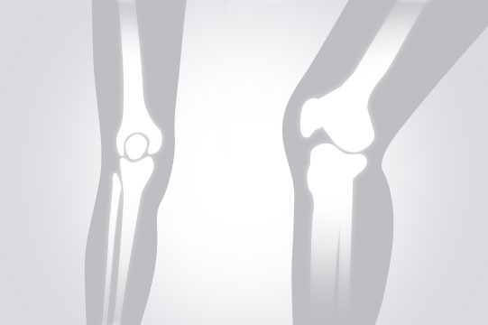 편측무릎 MRI(무릎정밀) 검사부위 그림